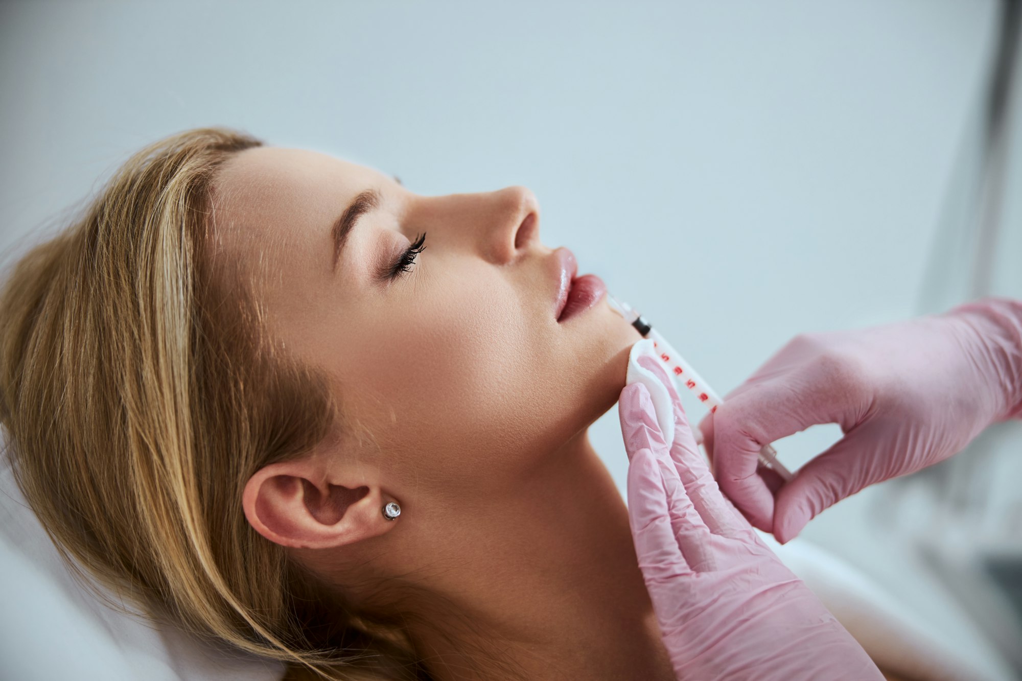 Lip filler