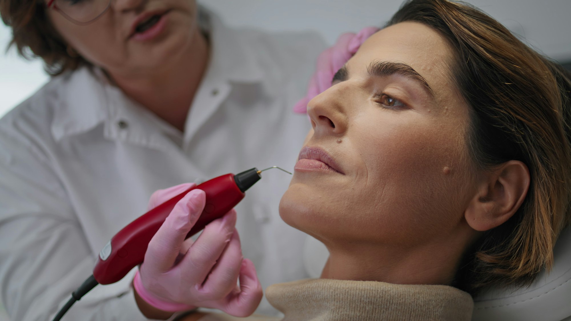 Close-up of an advanced plasma skin rejuvenation treatment in a cosmetic clinic