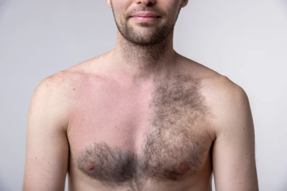 Waxing and sugaring
